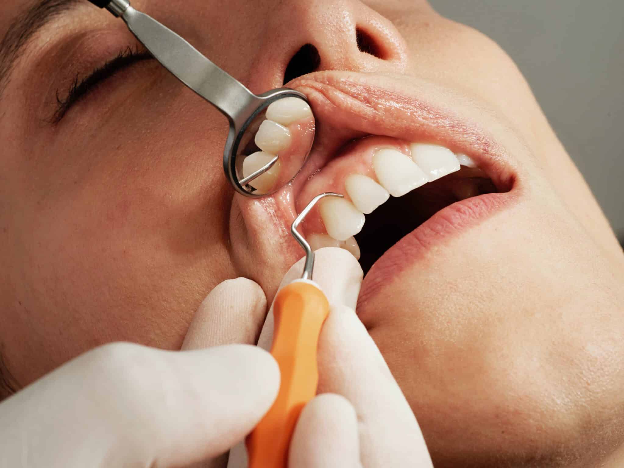 מטופלת בעת טיפול שיניים