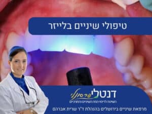 טיפולי שיניים בלייזר